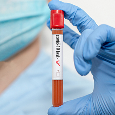 Coronavirus Diagnostic Test – COVID 19 Test Kits