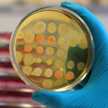 What is Bacteria Culture Test?