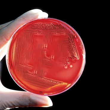 What is a Bacteria Culture Test?
